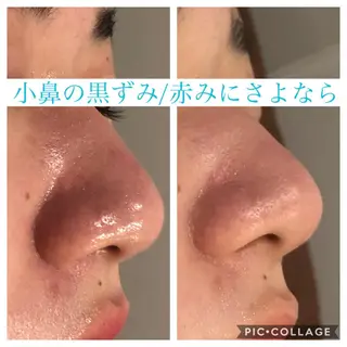 ショート カラー パーマ ヘアアレンジ キッズ ネイル マツエク・マツパ Ensor Clair所属・EnsorClair 代表 野口真央のエステ・リラクイメージ