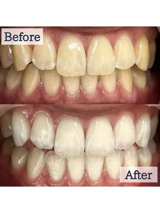 LBSホワイトニング上野店所属・LBSホワイトニング 🌐 上野店公式のエステ・リラクイメージ