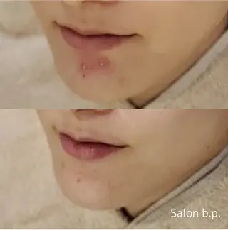 Salon b.p. 渋谷のエステ・リラクイメージ