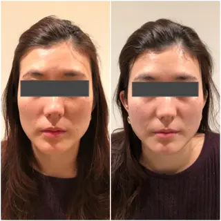 ComfortA🌱 はな💗のヘアスタイル