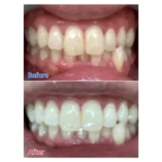 MBEAUTYSALON 千葉店・京成大久保所属・Melty 輝のその他イメージ