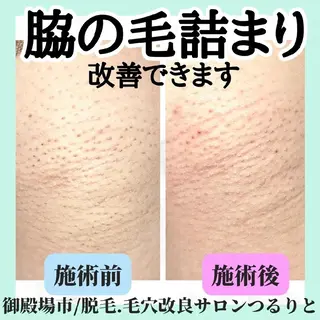 美肌脱毛サロン つるりと御殿場店所属・美肌脱毛サロン つるりとのその他イメージ