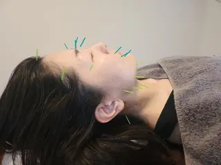 即効⚡小顔美容鍼🪡 むくみたるみ脂肪解消のエステ・リラクイメージ