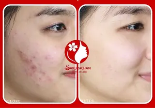 ニキビ、痩身、脱毛、 サクラチャンスパのエステ・リラクイメージ