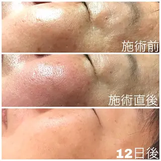 舟橋 優衣のエステ・リラクイメージ