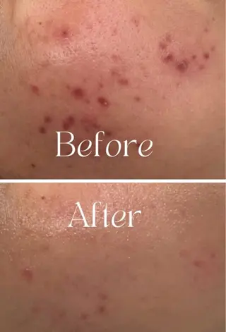 Nature Souce毛穴専門店のその他イメージ