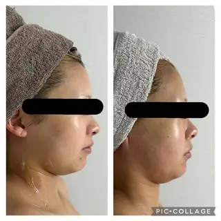 BeautySalonGemmy所属・Gemmy 愛美のエステ・リラクイメージ