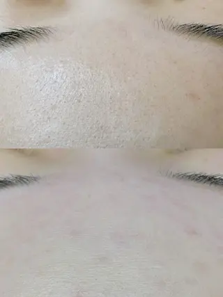 Hit. シュガーリング豊橋のエステ・リラクイメージ