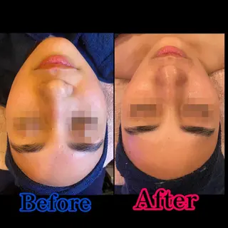 TEIKOKU所属・トータルビューティー TEIKOKUのエステ・リラクイメージ