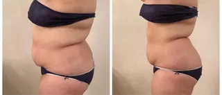 FLEUR大阪・美容 整体・痩身・小顔のエステ・リラクイメージ