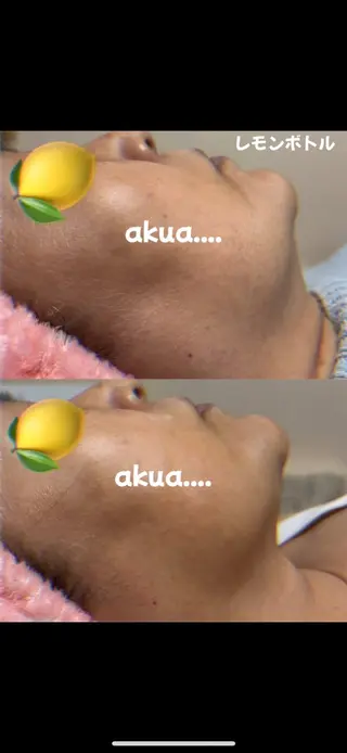 akua...痩身・ 脱毛・ホワイトニングのその他イメージ