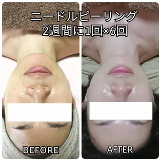 未病ケアサロン EMINY所属・未病ケアサロン EMINY☺︎勝俣のエステ・リラクイメージ