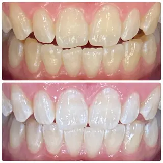 PLATINUM Beauty 横浜店所属・ホワイトニングルーム 横浜店のその他イメージ