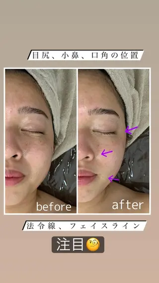 ビューティーサロンLEMO所属・ビューティーサロン Lemoのエステ・リラクイメージ