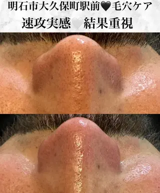 セルフエステエンリケ明石大久保店所属・夕希リンパ&痩身& 脱毛&毛穴ケアのエステ・リラクイメージ