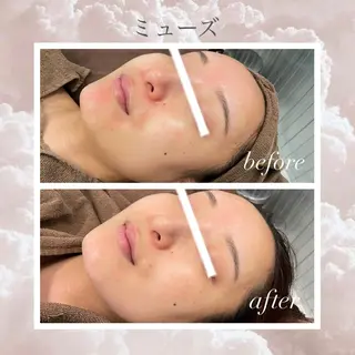 🦋美肌サロン. maho🦋のエステ・リラクイメージ