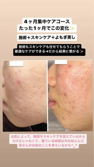 ベラージュ【美背中・ 美尻・フェイシャル】のエステ・リラクイメージ