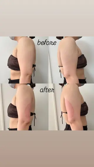 Miiju.所属・Miiju. 石巻市 脂肪冷却  鈴木のエステ・リラクイメージ