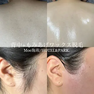 HOTEL&PARK .Moeワックス脱毛のエステ・リラクイメージ