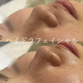 フェイシャルサロン CHIARA 荒田のエステ・リラクイメージ