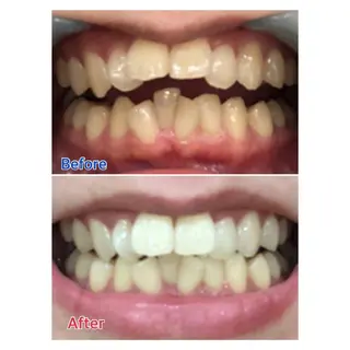 MBEAUTYSALON 千葉店・京成大久保所属・Melty 輝のその他イメージ