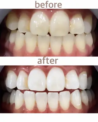 メンズ ホワイトニング ショップ船橋店のエステ・リラクイメージ