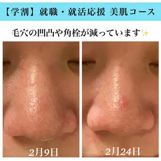 Bellesthe (ベルエステ)のエステ・リラクイメージ