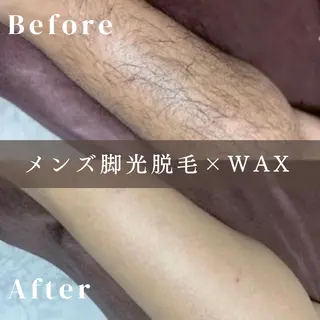 メンズ 《脱毛/韓国肌管理サロン》Epina -エピナ- 横浜店所属・脱毛/韓国肌管理 Epina 横浜店のその他イメージ