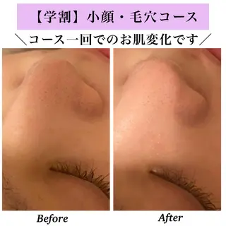 Bellesthe (ベルエステ)のエステ・リラクイメージ