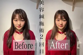 鍼灸整骨院Refine所属・鍼灸 Refineのその他イメージ