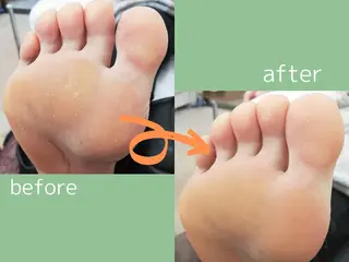 ネイル blanca🌺 mayu(東白楽)のマツエク・マツパデザイン