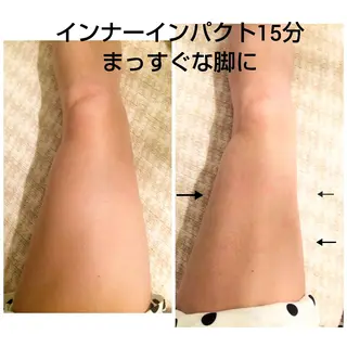 【ニキビ/肌管理】 salon varyのエステ・リラクイメージ