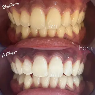 メンズ キッズ ホワイトニングサロン Ecru所属・ホワイトニングサロン Ecru エクリュのその他イメージ