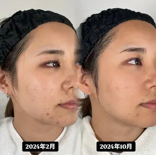 🫧美しい素肌へ🫧 今成柚乃のその他イメージ