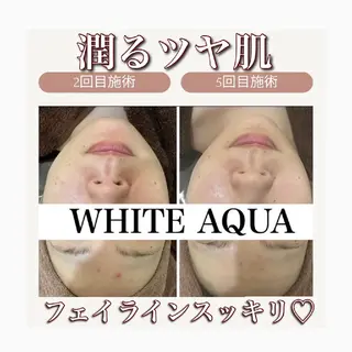 WhiteAqua 博多店　Erikoのエステ・リラクイメージ