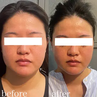 骨気&Relaxation vivian所属・VIVIAN 前田のエステ・リラクイメージ