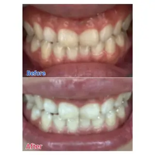 MBEAUTYSALON 千葉店・京成大久保所属・Melty 輝のその他イメージ