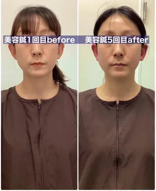 hari salon de off 美容鍼灸×小顔整体【ハリサロンドオフ】所属・美容鍼×小顔整体🤍 ishibashiのエステ・リラクイメージ