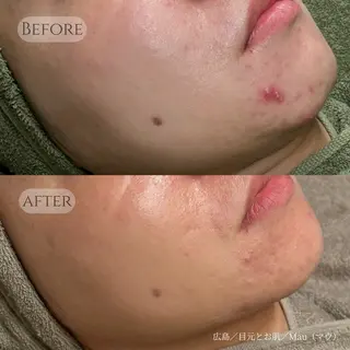 Mau beauty salon所属・Mau (マウ)のエステ・リラクイメージ