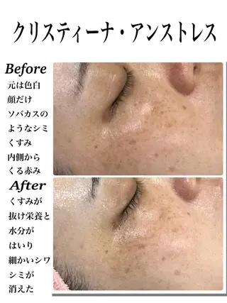 Euphoria所属・肌質管理エステ/脱毛 Mahinaのエステ・リラクイメージ