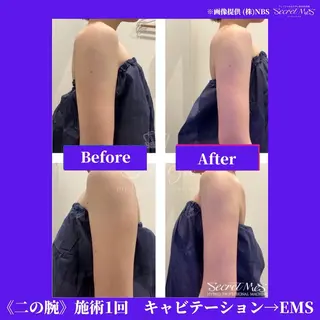 メンズ 有人型セルフサロン 脱毛/痩身/美顔のその他イメージ