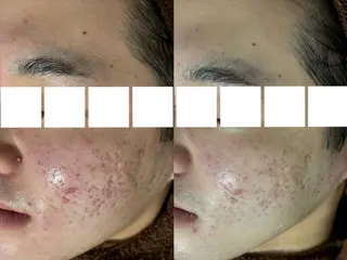 beauty salon　REBORN所属・REBORN所属 小山のエステ・リラクイメージ