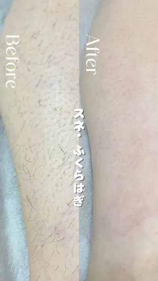 Hit. シュガーリング豊橋のエステ・リラクイメージ