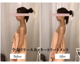 痩身×フェイシャル ブライダル|Linoのエステ・リラクイメージ