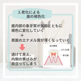 ホワイトニング｜韓国式3D毛穴洗浄 lonhana ﾛﾝﾊﾅ所属・韓国式3D毛穴洗浄 lonhanaのその他イメージ