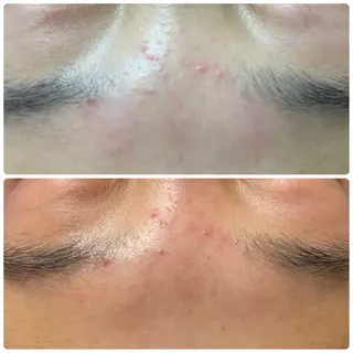 🔰 新米ネイリストのネイルデザイン