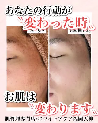 メンズ キッズ WHITEAQUA 福岡天神店のエステ・リラクイメージ