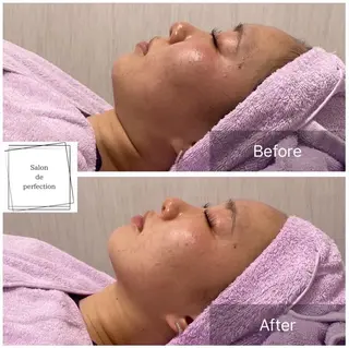 salon de perfectionのエステ・リラクイメージ