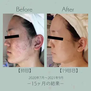 エステツイン広島店 FacialBodyのエステ・リラクイメージ