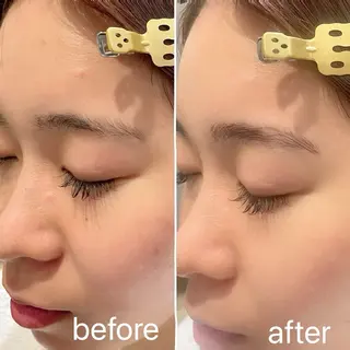 アイブロウ 痛くないシミ取り 【荻窪】石橋のヘアスタイル